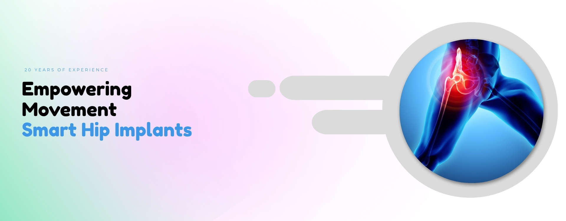 Empowering Movement Smart Hip Implants 1