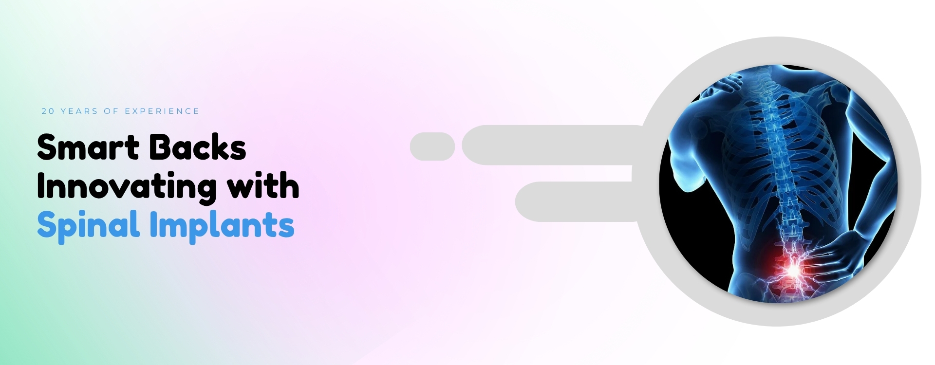 Smart Backs Innovating with Spinal Implants 1